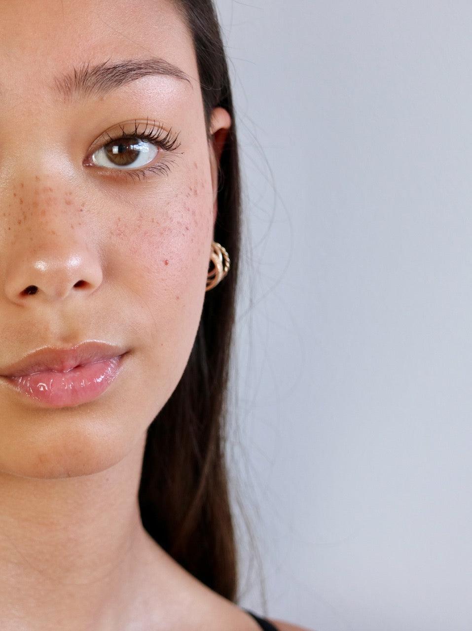 Why Faux Freckles? - Fauxfreck